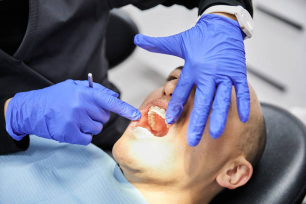 Best Emergency Wisdom Teeth Removal in Sheboygan, WI